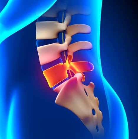 The Importance of Lumbar Support for a Healthy Spine